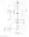 Fig. 07 - Optical measurement systems and processes with wavefront aberrometer having variable focal length lens