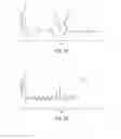Fig. 04 - Applications of vasculature mapping using laser speckle imaging