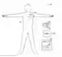 Fig. 01 - Brady pause detection for implantable cardiac monitors