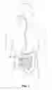 Fig. 02 - Intraluminal devices with deployable elements