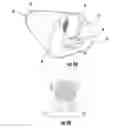 Fig. 14 - Portable spirometer and method for monitoring lung function