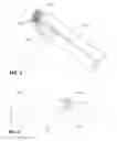 Fig. 02 - Smartphone Based Peak Flow Meter