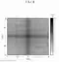 Fig. 09 - Device and method for spectrum analysis and device for blood glucose measurement