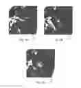 Fig. 04 - SIMULTANEOUSLY DISPLAYING MEDICAL IMAGES