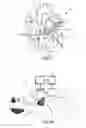 Fig. 02 - Method and apparatus for treating valvular disease
