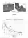Fig. 16 - Method and apparatus for treating valvular disease