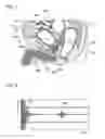Fig. 06 - STOOL AMOUNT ESTIMATING APPARATUS AND STOOL AMOUNT ESTIMATING METHOD