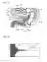 Fig. 09 - STOOL AMOUNT ESTIMATING APPARATUS AND STOOL AMOUNT ESTIMATING METHOD