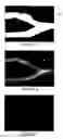 Fig. 06 - Wall-to-wall vessel segmentation in US imaging using a combination of VFI data and US imaging data