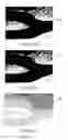 Fig. 07 - Wall-to-wall vessel segmentation in US imaging using a combination of VFI data and US imaging data