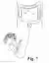 Fig. 08 - Dual movable blade biopsy tool for multiple core biopsy