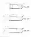 Fig. 19 - Dual movable blade biopsy tool for multiple core biopsy
