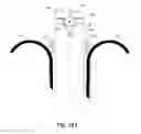 Fig. 24 - Dual movable blade biopsy tool for multiple core biopsy