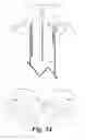 Fig. 44 - Dual movable blade biopsy tool for multiple core biopsy
