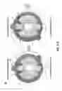 Fig. 05 - Methods and devices for cervical cell and tissue sampling