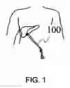 Fig. 02 - Surgical instruments with multiple degrees of freedom and methods of using the same