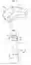 Fig. 02 - Apparatus and method for heart valve repair