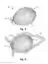 Fig. 06 - Occluder For Occluding An Atrial Appendage And Production Process Therefor