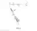 Fig. 05 - Angled surgical tool for removing tissue from within an intervertebral space