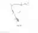 Fig. 09 - Angled surgical tool for removing tissue from within an intervertebral space