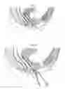 Fig. 02 - Surgical instrument