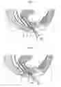 Fig. 04 - Surgical instrument