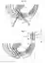 Fig. 09 - Surgical instrument