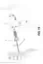 Fig. 32 - Percutaneous lateral recess resection methods and instruments