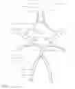 Fig. 02 - Rotating separator, irrigator microcatheter for thrombectomy
