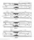 Fig. 03 - Atherectomy devices and methods
