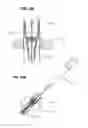 Fig. 22 - IMPLANT AND FASTENER FIXATION DEVICES