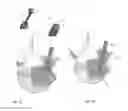 Fig. 03 - Orthopedic stabilization devices and methods for installation thereof