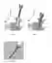 Fig. 04 - Orthopedic stabilization devices and methods for installation thereof