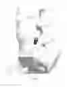 Fig. 20 - Orthopedic stabilization devices and methods for installation thereof