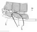 Fig. 09 - Tethering screw system
