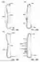 Fig. 08 - METHODS AND SYSTEMS FOR LATERALLY STABILIZED CONSTRAINT OF SPINOUS PROCESSES