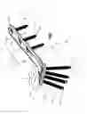 Fig. 02 - Variable angle bone plate