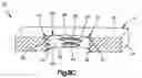 Fig. 08 - Variable angle bone plate