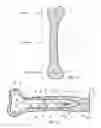 Fig. 08 - Load sharing bone plate