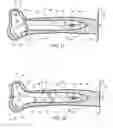 Fig. 09 - Load sharing bone plate
