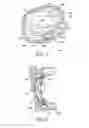 Fig. 03 - NON-SURGICAL ORBITAL FAT REDUCTION