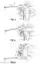 Fig. 04 - Surgical instruments and methods for performing tonsillectomy, adenoidectomy, and other surgical procedures