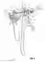 Fig. 07 - Surgical instruments and methods for performing tonsillectomy, adenoidectomy, and other surgical procedures