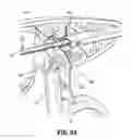 Fig. 08 - Surgical instruments and methods for performing tonsillectomy, adenoidectomy, and other surgical procedures