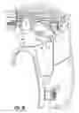 Fig. 28 - Surgical instruments and methods for performing tonsillectomy, adenoidectomy, and other surgical procedures