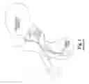 Fig. 02 - Artificial sphincter system and method
