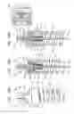 Fig. 25 - Cardiac tissue cinching