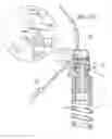 Fig. 35 - Cardiac tissue cinching
