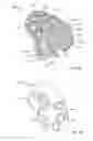 Fig. 09 - Orthopedic augments having recessed pockets