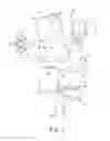 Fig. 02 - KNEE PROSTHESIS ASSEMBLY HAVING PROPORTIONAL TROCHLEAR GROOVE GEOMETRY
